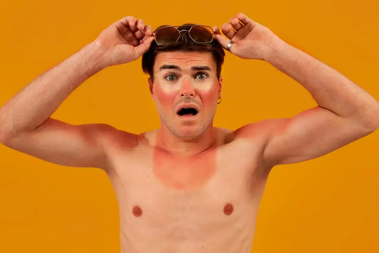 Different Types of Sunburn and How to Avoid Them