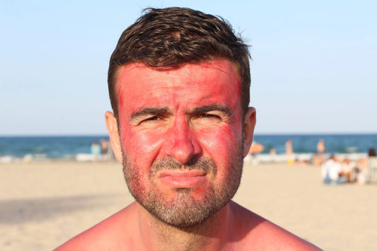 How Sunburn Drink Works