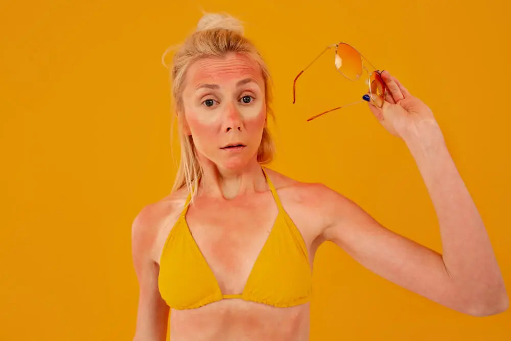 Your Guide to How long does sunburn last?