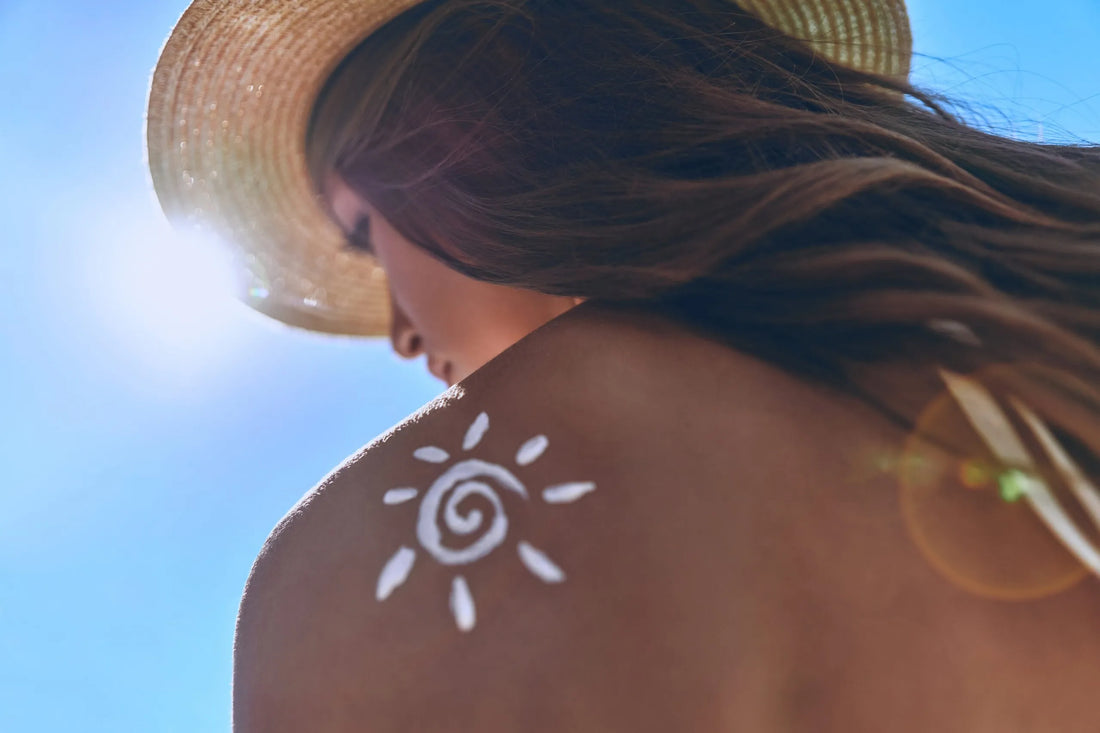 How Quickly Can You Heal Sunburn?