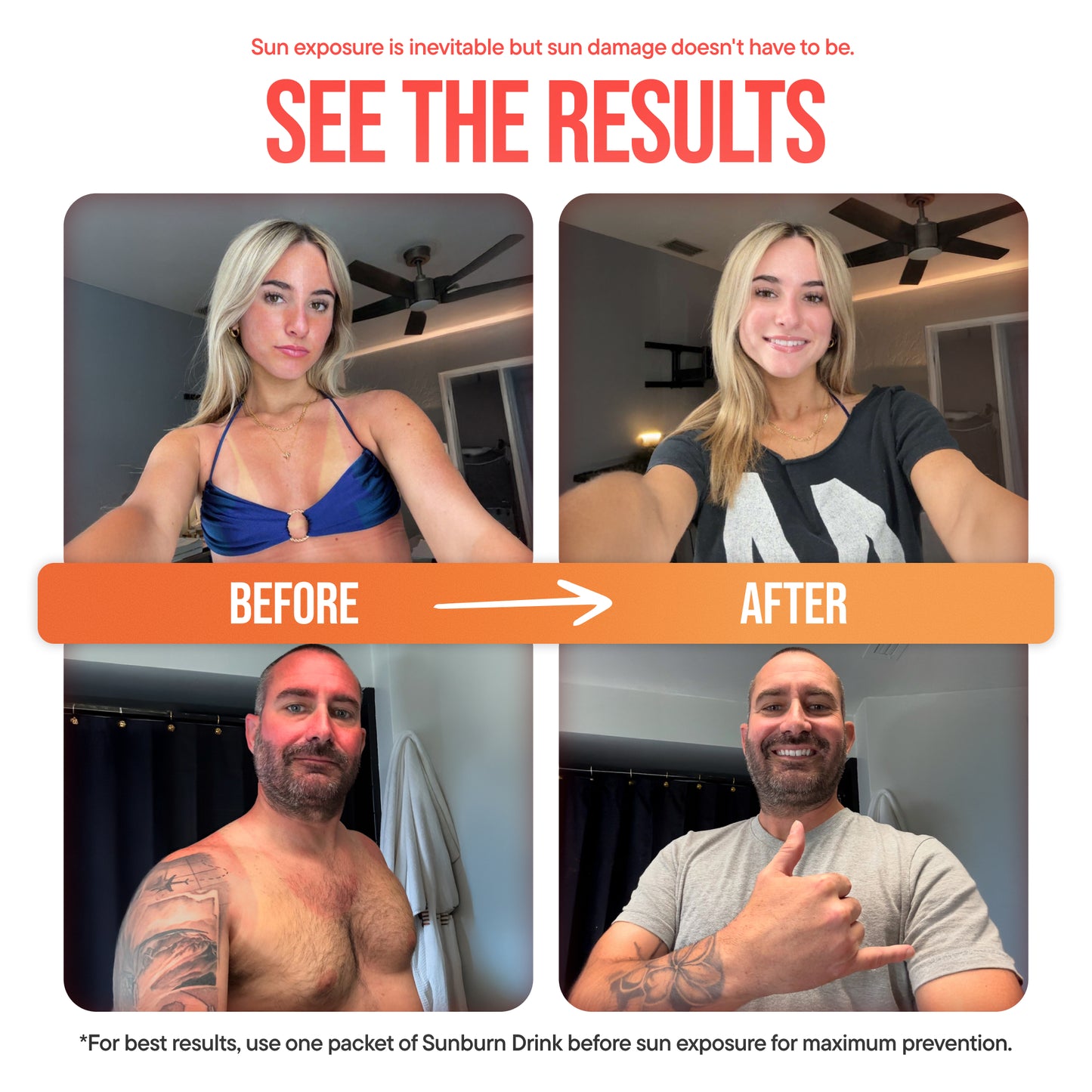 Sunburn Drink 20 Pack, Zero Sugar After Sun Hydration